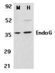 Anti-EndoG antibody used in Western Blot (WB). GTX10522